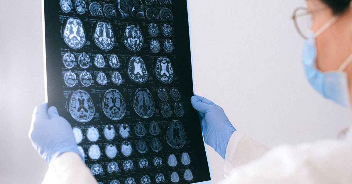 OR nurse in surgical scrubs preparing in an operating room